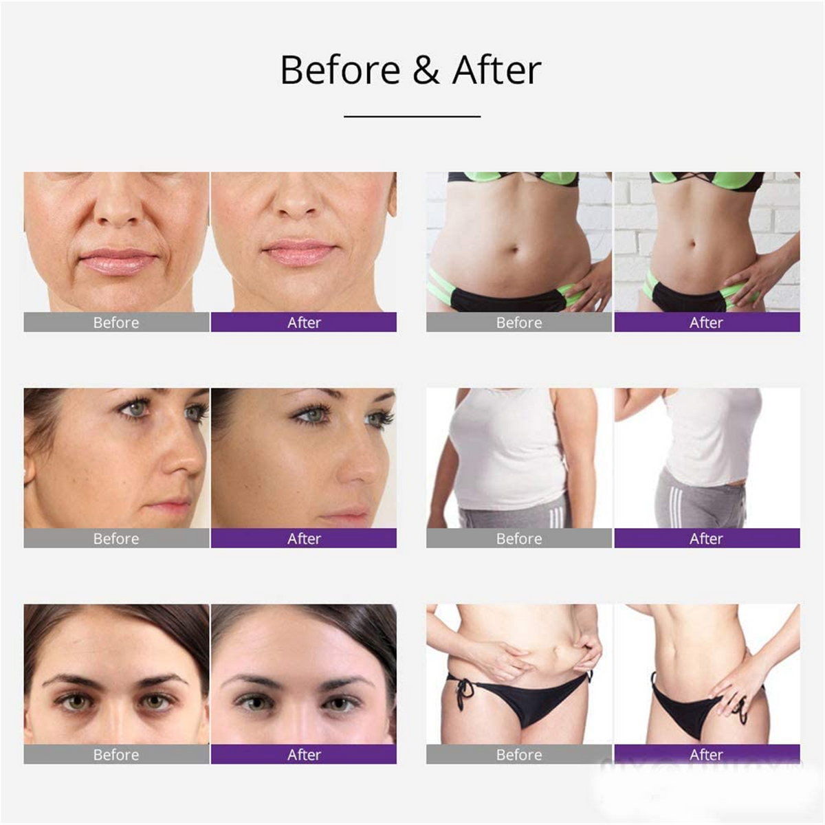 ArianaSpas 30K 5-in-1 body contouring before-and-after examples