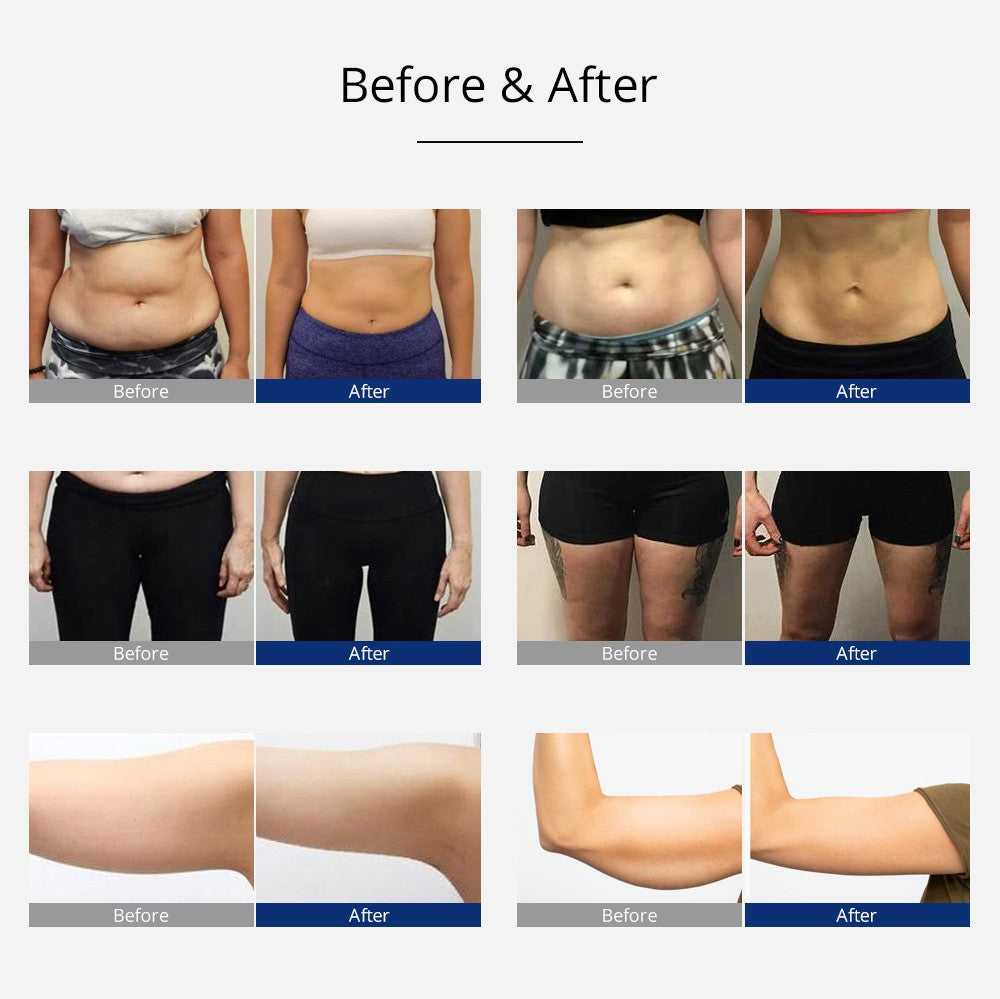 5 in 1 Ultrasonic 40K Cavitation with Rotary - Rotating RF image 4