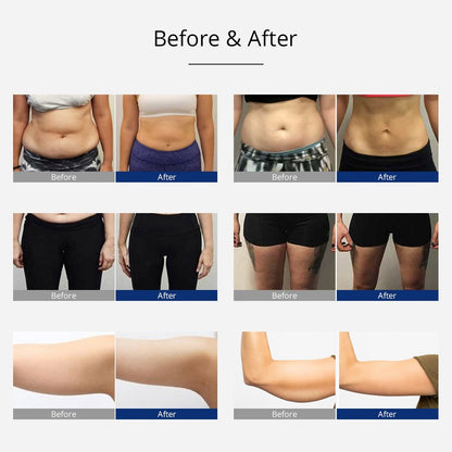 5 in 1 Ultrasonic 40K Cavitation with Rotary - Rotating RF image 4